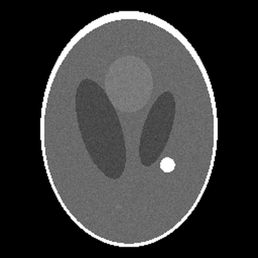 Synthetic CT phantom slice with one flagged region